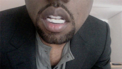 kanye_west_diamond_teeth kanye_west_diamond_teeth